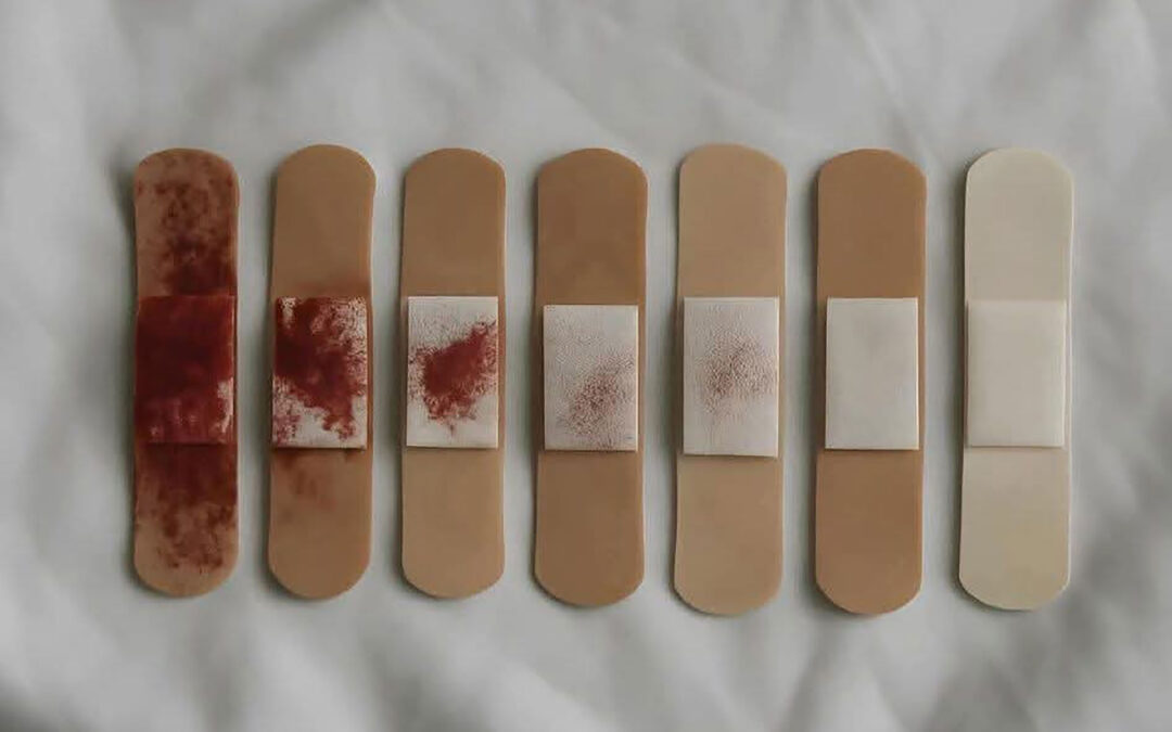 The war has ended…